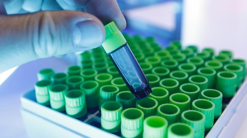 外泌体热潮引关注，多家公司迅速行动；监管趋严下市场面临调整。